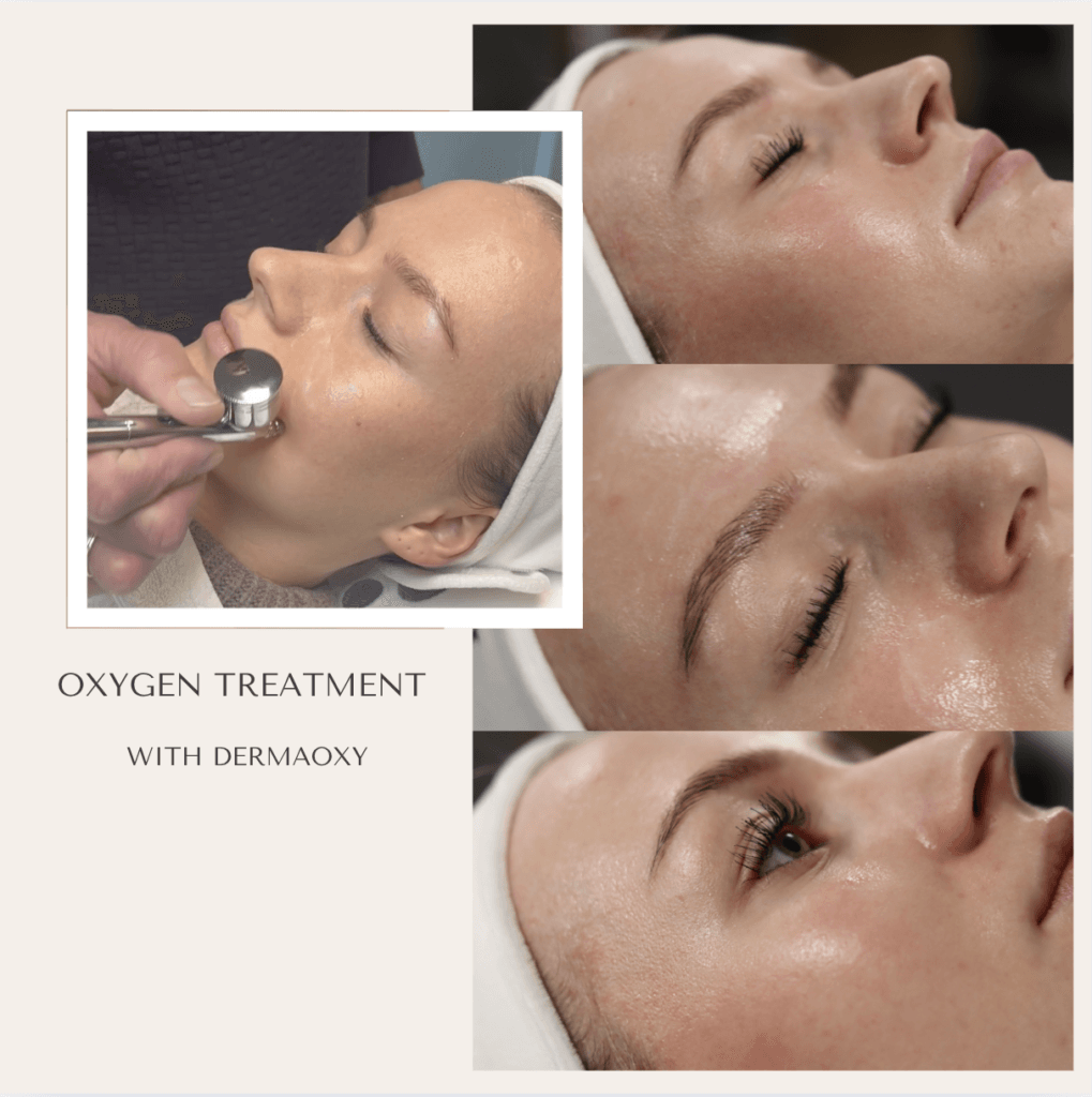 oxygenbehandling - MB Hudpleje - Alberte NY 6 - Oxygenbehandling oxygenbehandling - MB Hudpleje - Alberte NY 6 - Oxygenbehandling